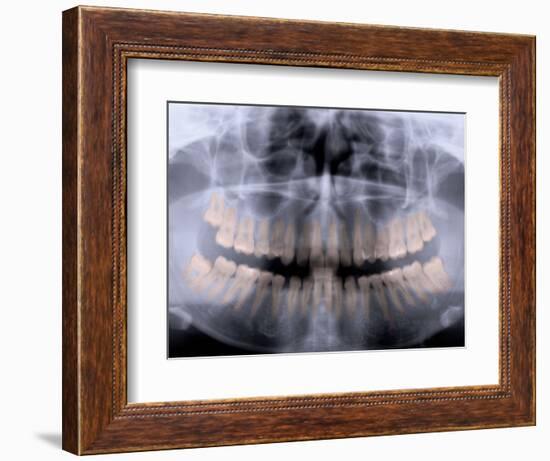 Panoramic X-Ray of Mouth-null-Framed Photographic Print