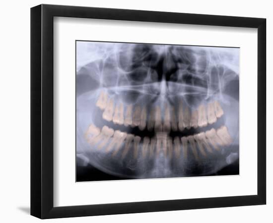 Panoramic X-Ray of Mouth-null-Framed Photographic Print