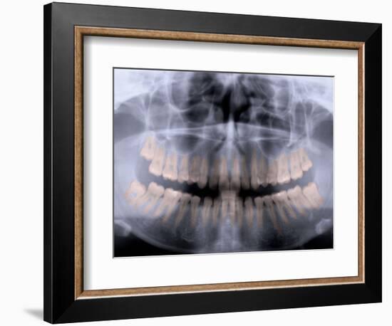 Panoramic X-Ray of Mouth-null-Framed Photographic Print