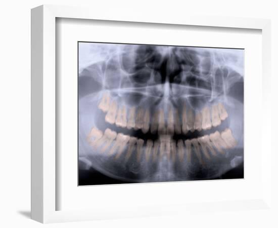 Panoramic X-Ray of Mouth-null-Framed Photographic Print