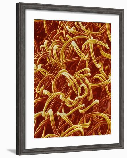 Panty Hose-Micro Discovery-Framed Photographic Print
