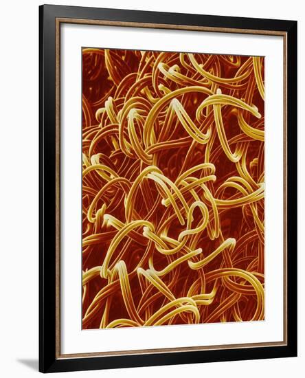 Panty Hose-Micro Discovery-Framed Photographic Print