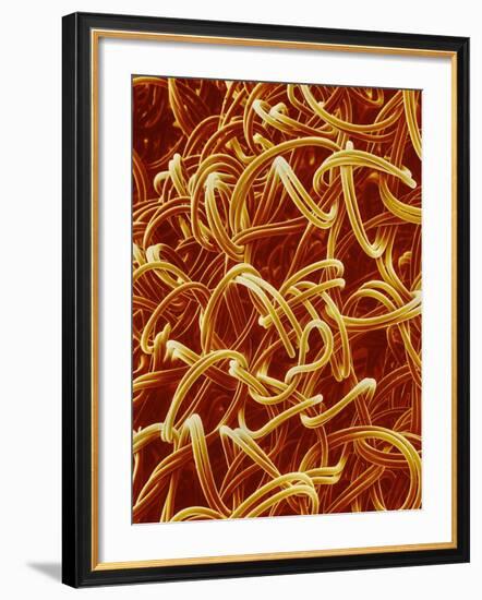 Panty Hose-Micro Discovery-Framed Photographic Print