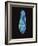 Paramecium Caudatum, Light Micrograph-Laguna Design-Framed Photographic Print