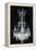 Paris Chandelier on Black 1-Morgan Yamada-Framed Stretched Canvas