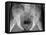 Pelvic Fracture, X-ray-Du Cane Medical-Framed Premier Image Canvas