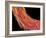 Penis Blood Vessels, SEM-Susumu Nishinaga-Framed Photographic Print