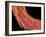 Penis Blood Vessels, SEM-Susumu Nishinaga-Framed Photographic Print