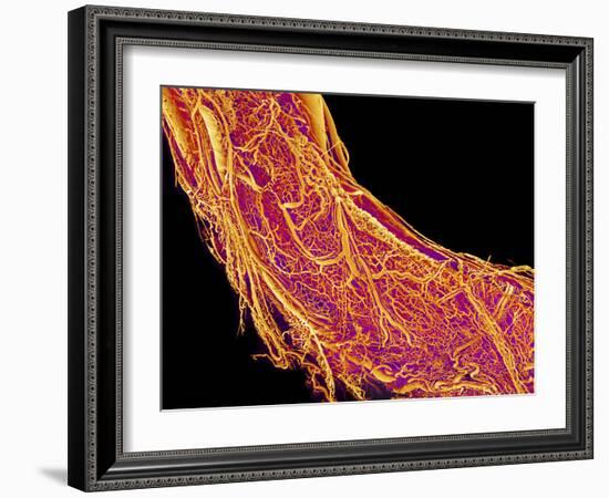 Penis Blood Vessels, SEM-Susumu Nishinaga-Framed Photographic Print