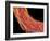 Penis Blood Vessels, SEM-Susumu Nishinaga-Framed Photographic Print