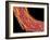 Penis Blood Vessels, SEM-Susumu Nishinaga-Framed Photographic Print