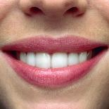 Close-up of a Woman's Mouth Showing Healthy Teeth-Phil Jude-Premium Photographic Print