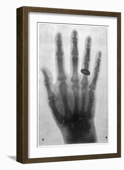 Photograph Taken by Dr. Voller of Hamburg Using the Roentgen System-null-Framed Premium Giclee Print