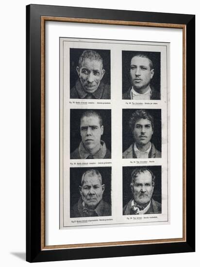 Photographs of Murderers Whose Criminal Nature Lombroso Believed is Revealed in Their Physiognomy-null-Framed Art Print