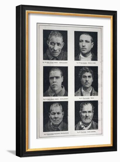 Photographs of Murderers Whose Criminal Nature Lombroso Believed is Revealed in Their Physiognomy-null-Framed Art Print