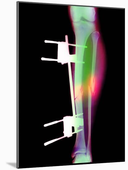 Pinned Broken Leg-Science Photo Library-Mounted Photographic Print