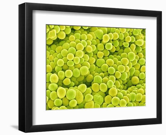 Pistil of Buttercup-Micro Discovery-Framed Photographic Print