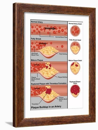 Plaque in Artery-Gwen Shockey-Framed Giclee Print