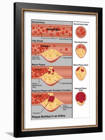 Plaque in Artery-Gwen Shockey-Framed Giclee Print