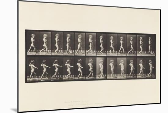 Plate 540.A, Bow Legs; Boy; B, Spinal Caries; Girl Walking, 1885 (Collotype on Paper)-Eadweard Muybridge-Mounted Giclee Print