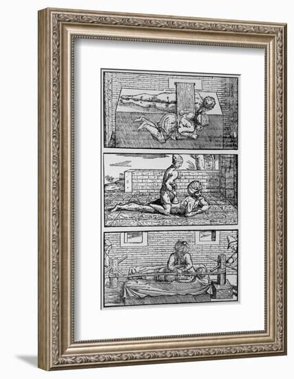 Plate Showing Avicenna's Cure for Spinal Fracture-Jeremy Burgess-Framed Photographic Print