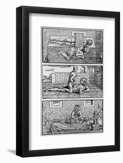 Plate Showing Avicenna's Cure for Spinal Fracture-Jeremy Burgess-Framed Photographic Print