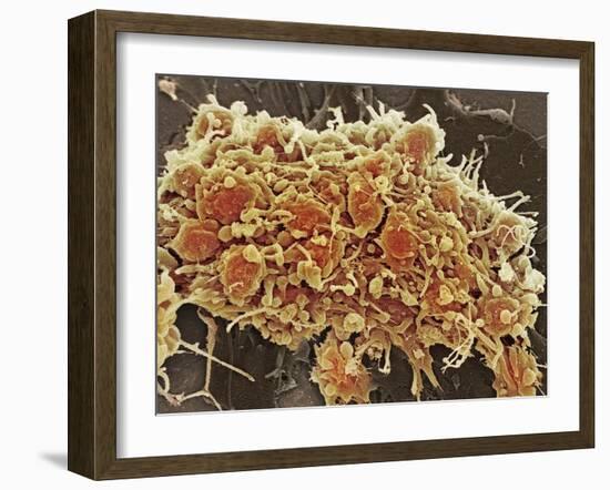 Platelets In a Blood Clot-Steve Gschmeissner-Framed Photographic Print