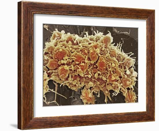 Platelets In a Blood Clot-Steve Gschmeissner-Framed Photographic Print