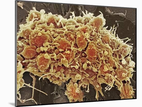 Platelets In a Blood Clot-Steve Gschmeissner-Mounted Photographic Print