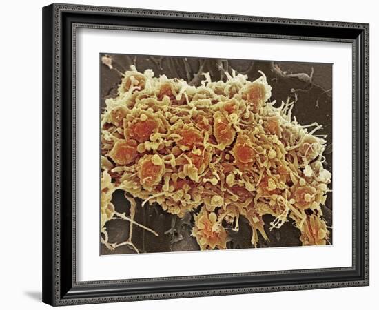 Platelets In a Blood Clot-Steve Gschmeissner-Framed Photographic Print