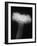 Plumose Anemone-Henry Horenstein-Framed Photographic Print