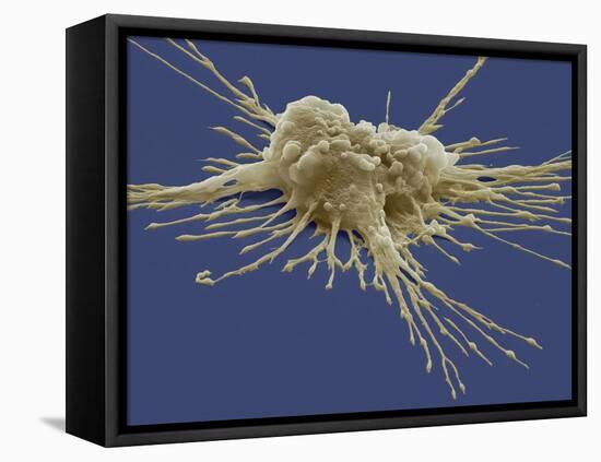 Pluripotent Stem Cell, SEM-Steve Gschmeissner-Framed Premier Image Canvas