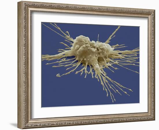 Pluripotent Stem Cell, SEM-Steve Gschmeissner-Framed Photographic Print