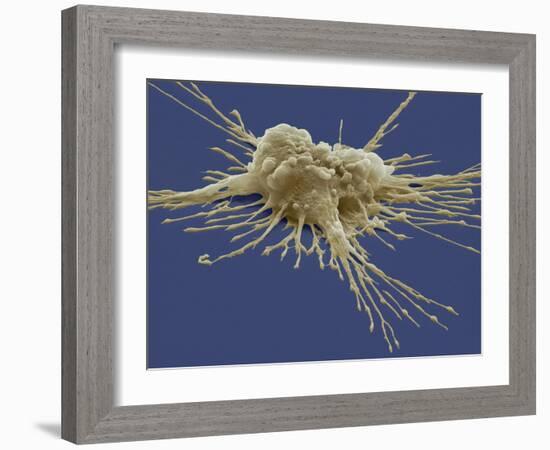 Pluripotent Stem Cell, SEM-Steve Gschmeissner-Framed Photographic Print