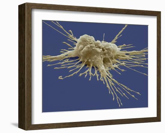 Pluripotent Stem Cell, SEM-Steve Gschmeissner-Framed Photographic Print