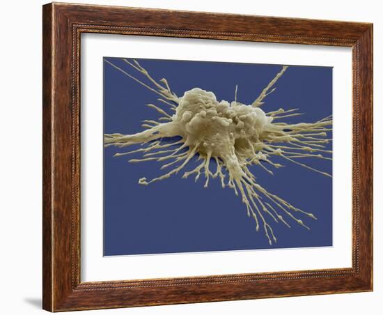 Pluripotent Stem Cell, SEM-Steve Gschmeissner-Framed Photographic Print