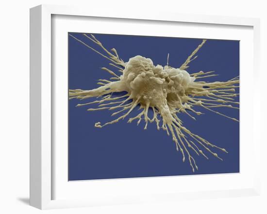 Pluripotent Stem Cell, SEM-Steve Gschmeissner-Framed Photographic Print