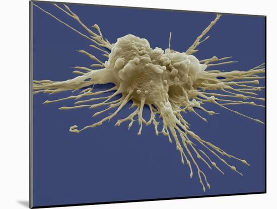 Pluripotent Stem Cell, SEM-Steve Gschmeissner-Mounted Photographic Print