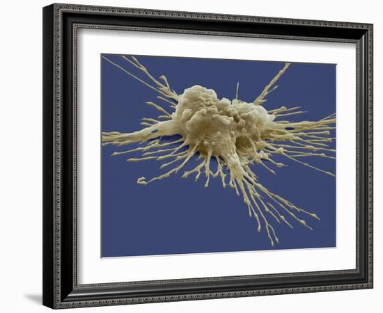 Pluripotent Stem Cell, SEM-Steve Gschmeissner-Framed Photographic Print