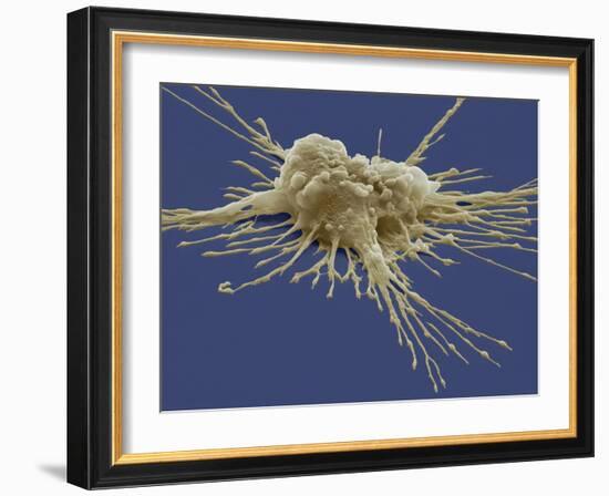 Pluripotent Stem Cell, SEM-Steve Gschmeissner-Framed Photographic Print