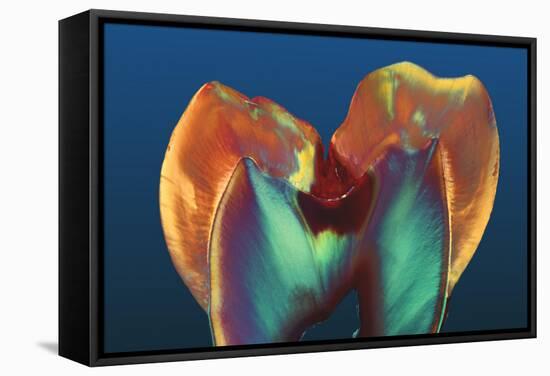 Polarised LM of a Molar Tooth Showing Decay-Volker Steger-Framed Premier Image Canvas