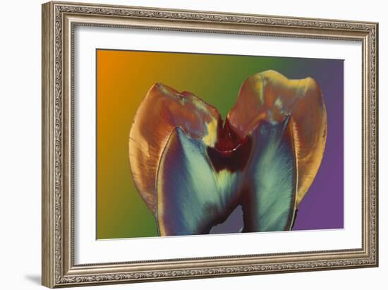 Polarised LM of a Molar Tooth Showing Decay-Volker Steger-Framed Photographic Print