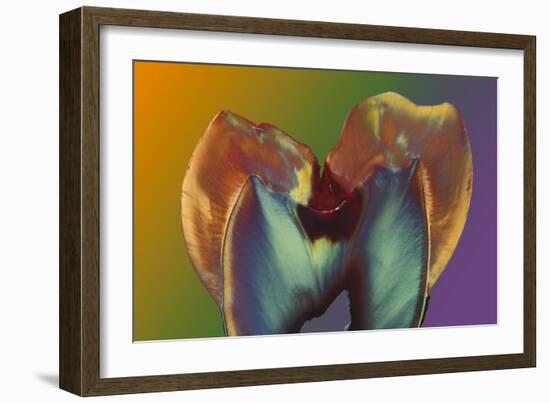 Polarised LM of a Molar Tooth Showing Decay-Volker Steger-Framed Photographic Print