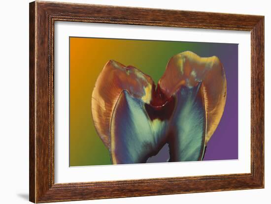 Polarised LM of a Molar Tooth Showing Decay-Volker Steger-Framed Photographic Print