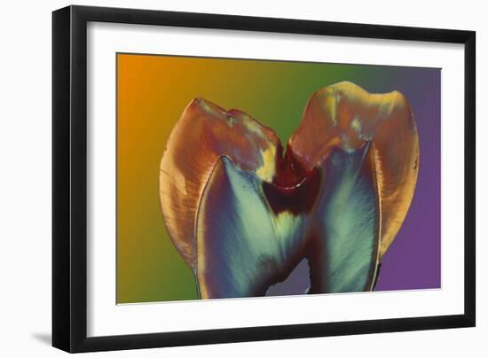 Polarised LM of a Molar Tooth Showing Decay-Volker Steger-Framed Photographic Print