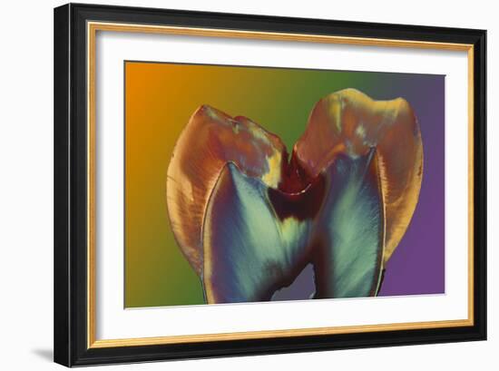Polarised LM of a Molar Tooth Showing Decay-Volker Steger-Framed Photographic Print