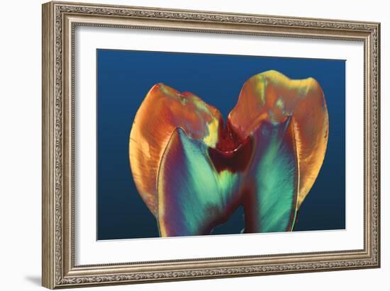 Polarised LM of a Molar Tooth Showing Decay-Volker Steger-Framed Photographic Print