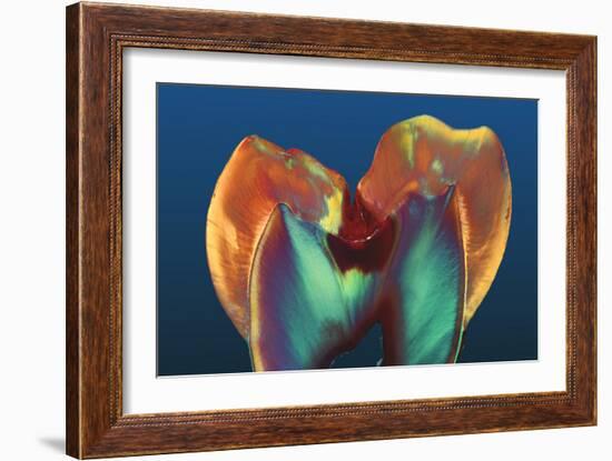 Polarised LM of a Molar Tooth Showing Decay-Volker Steger-Framed Photographic Print