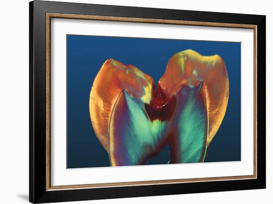 Polarised LM of a Molar Tooth Showing Decay-Volker Steger-Framed Photographic Print