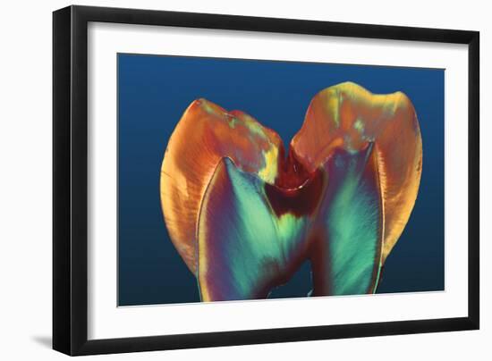 Polarised LM of a Molar Tooth Showing Decay-Volker Steger-Framed Photographic Print